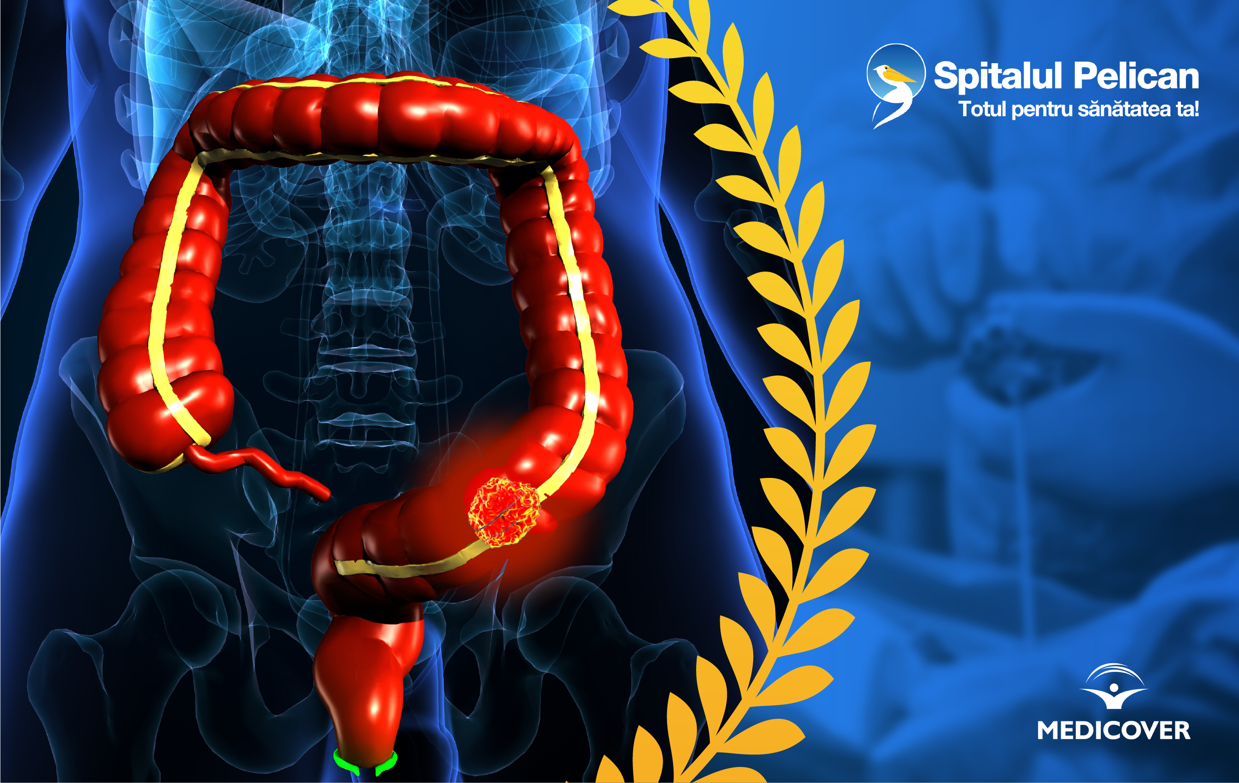Centrul de excelenta in chirurgia colorectala