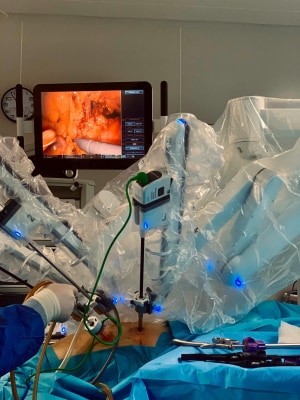 Fost miner, operat robotic la colon