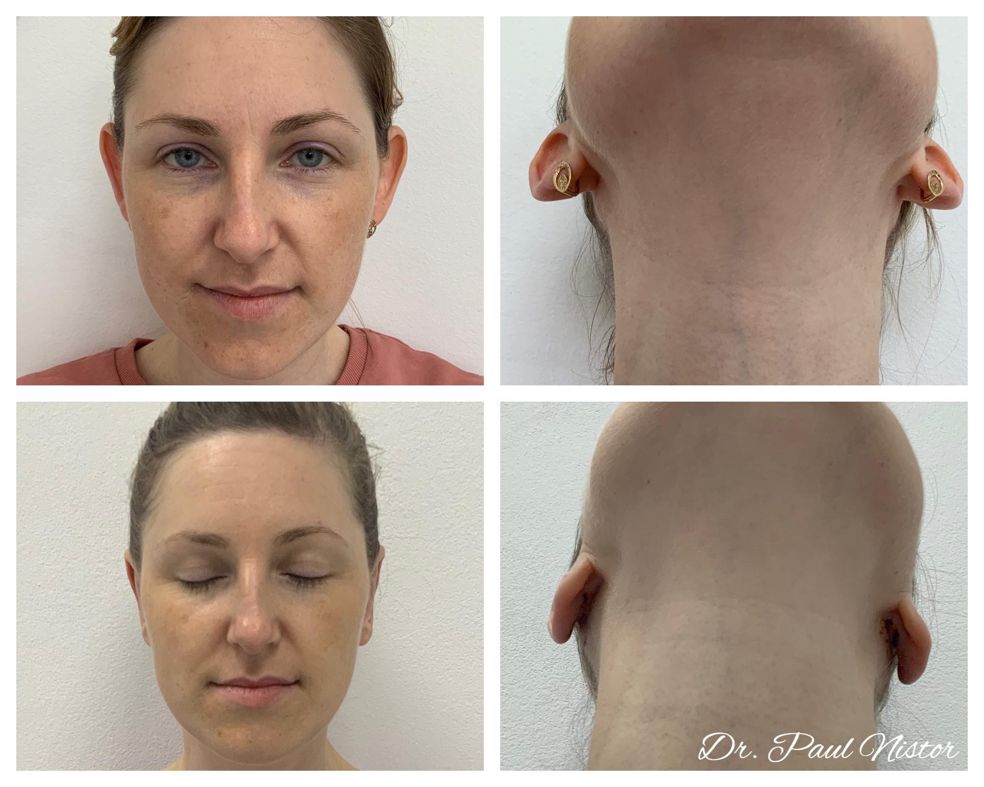 PACIENTA: „Aici lucrurile se misca mai repede”